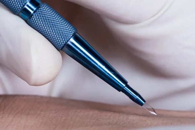 Пересадка волос Sapphire